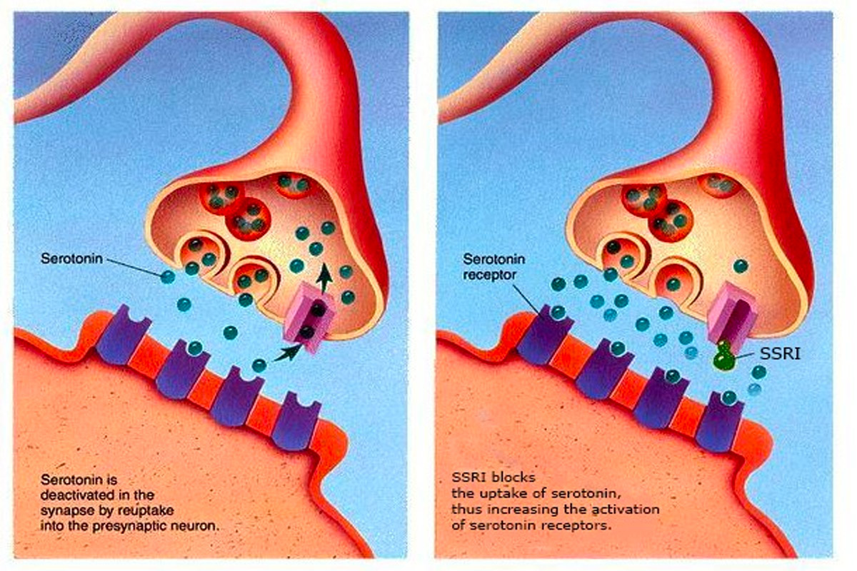 How SSRIs Work